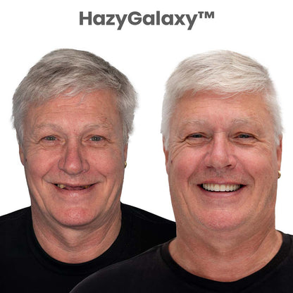 🦷 HazyGalaxy™ Custom-Fit Dentures ⏰ ENDS TODAY   70% OFF | Smile with Confidence