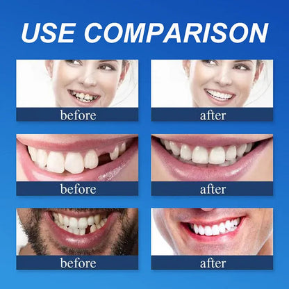 🌈Ends Today: 70% OFF! ⏰HazyGalaxy™  Medical Full Denture with Strong Suctiond Custom-Fit Full Functional Dentures🦷
